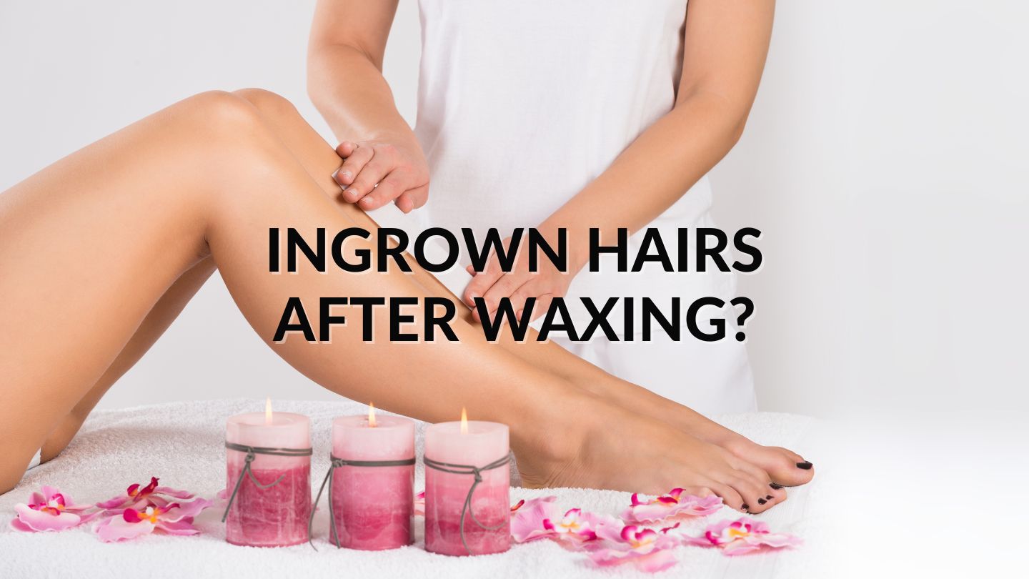 How to Prevent Ingrown Hairs After Waxing