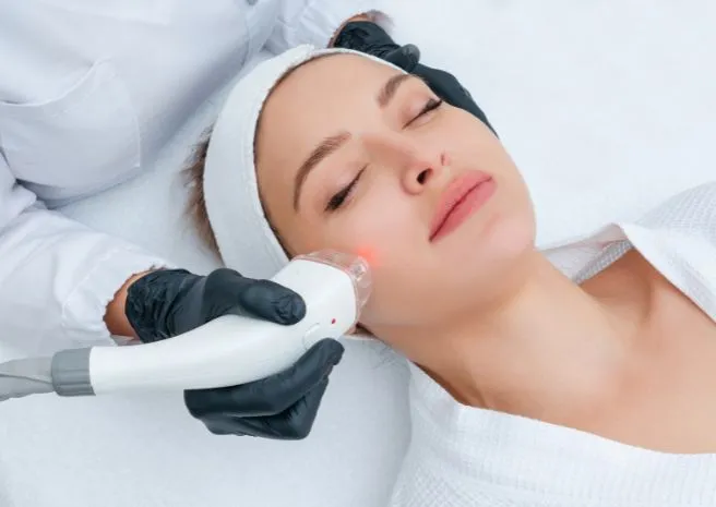 Facial Laser Hair Removal