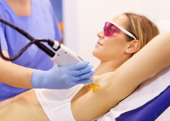 Underarm Laser Hair Removal